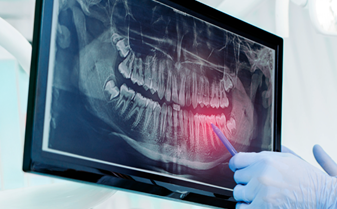 SEP-RadiologiaSemipresencial-2026