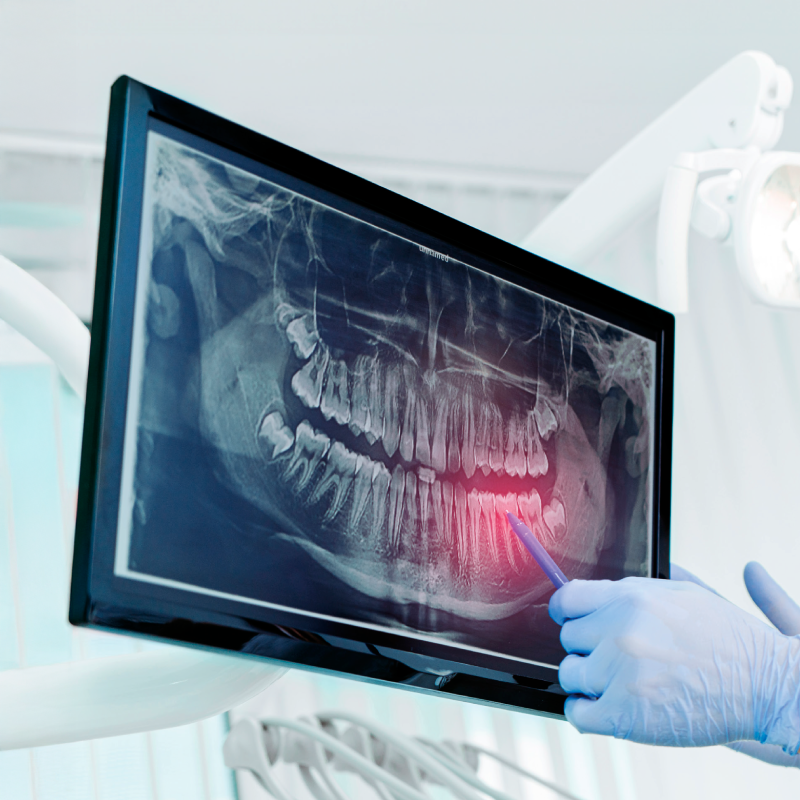 esp-radiologia-bucal-maxilofacial-semipresencial-2026-post